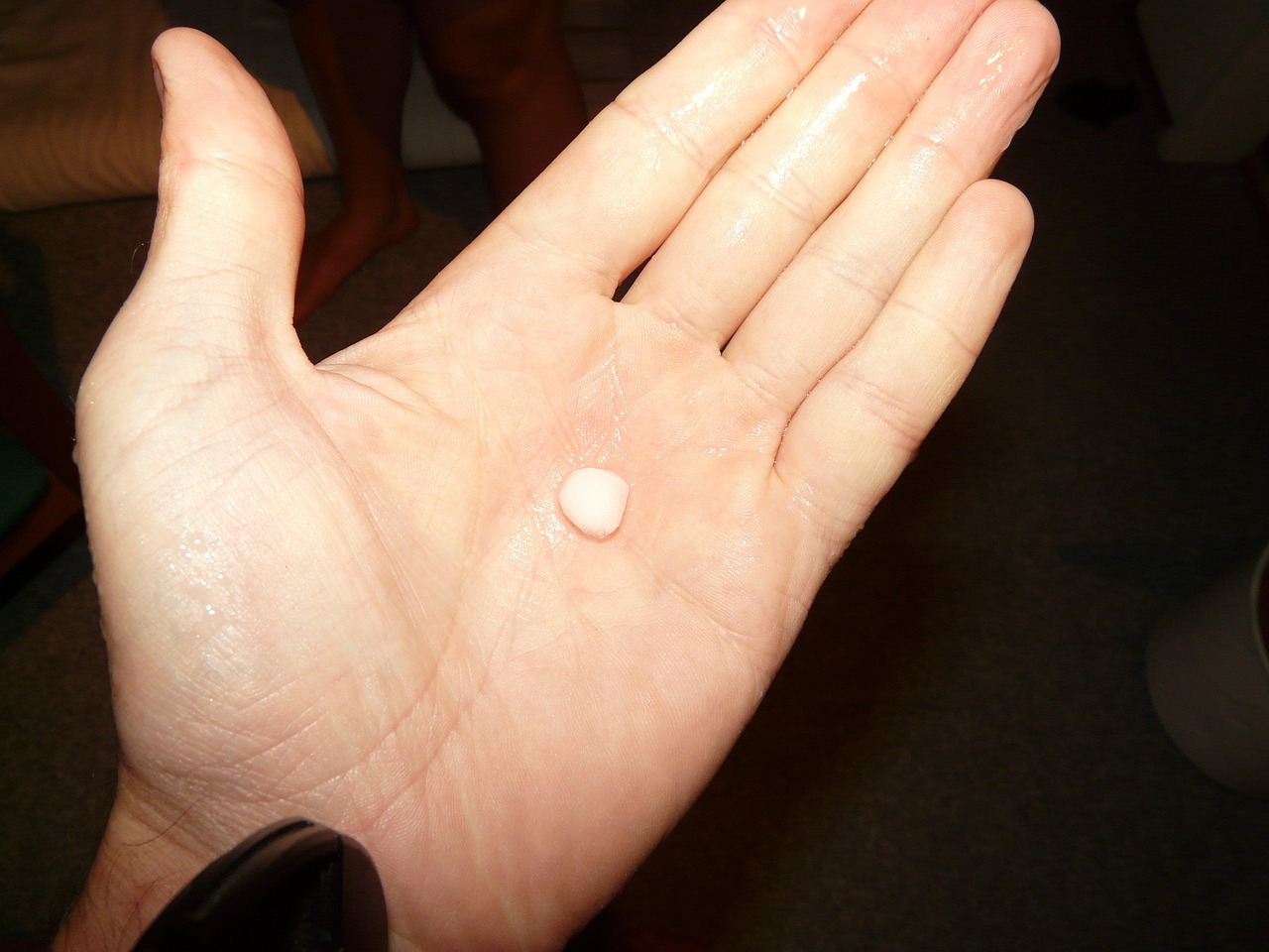 Chuva de granizo ou granito? Saiba o termo correto e evite confusão