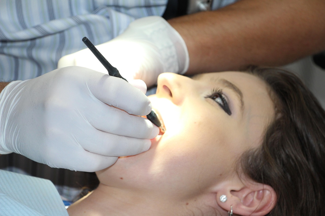 Quantos Dentes Têm um Tubarão Branco? Fatos Surpreendentes